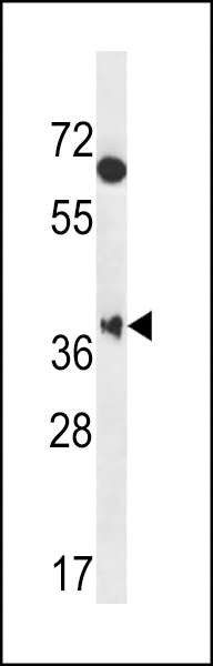 WB - MBNL2 Antibody (C-term) AP13023B